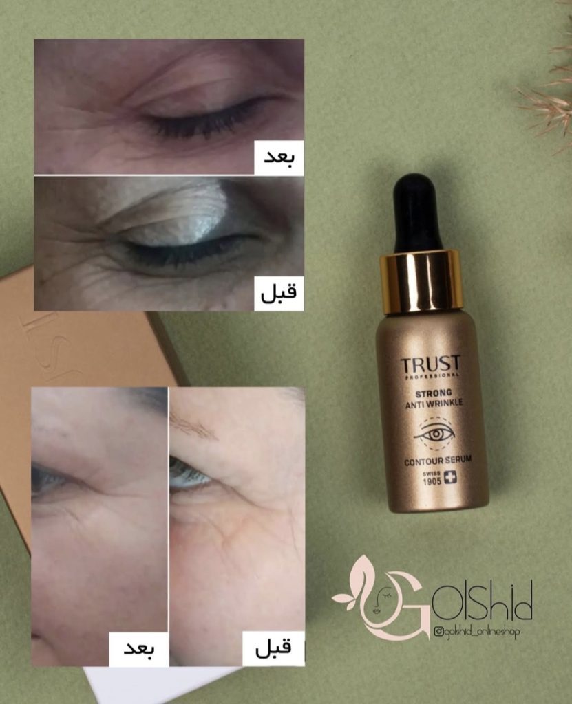 سرم دور چشم تراست