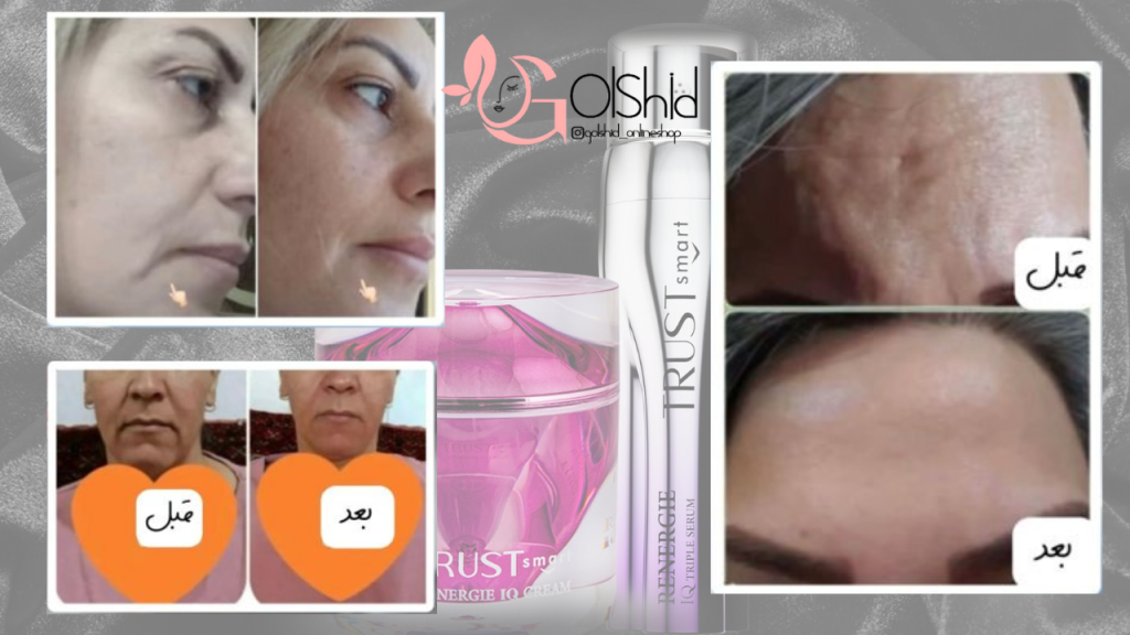 قبل و بعد کرم سه گانه تراست