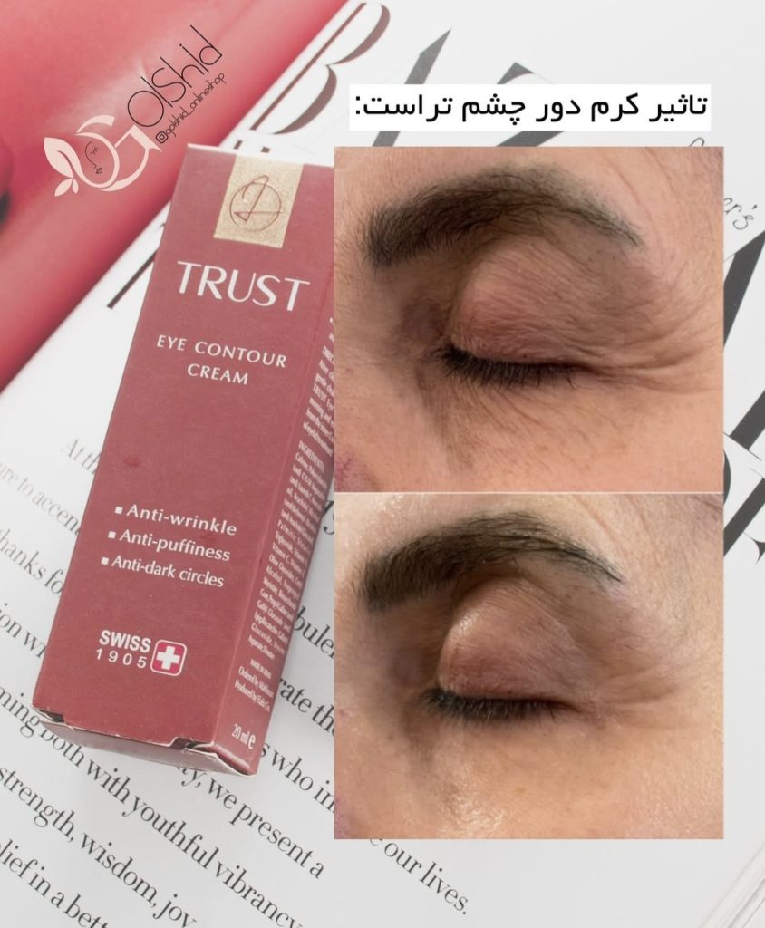 کرم دور چشم تراست