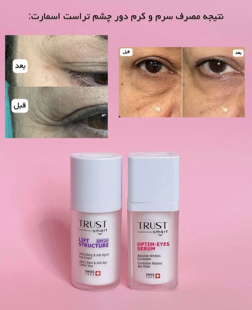 کرم دور چشم تراست اسمارت