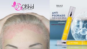 سرم آنتی پسوریازیس تراست